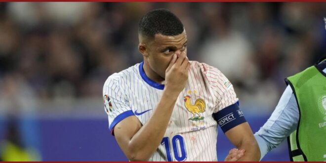 Eurocopa 2024: Sorpresas, golpes y un inicio accidentado