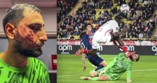 Donnarumma sufre impactante lesión facial en el partido PSG-Mónaco: "Me pusieron 10 grapas"
