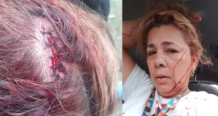 INADEH Condena Ataque con Machete a Funcionaria en Bocas del Toro