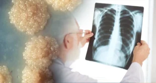 China nos vuelve a Infectar ahora con Tuberculosis Beijing