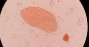 ¿Sabes lo que comes cuando pides Sushi?