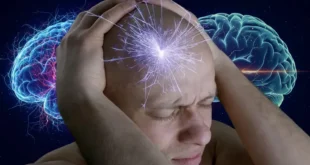 Representación médica de un cerebro humano mostrando actividad neuronal durante un episodio de migraña