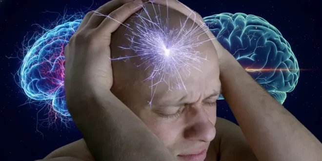 Representación médica de un cerebro humano mostrando actividad neuronal durante un episodio de migraña