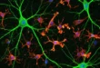 Representación microscópica de células de microglía protegiendo conexiones neuronales en el cerebro humano