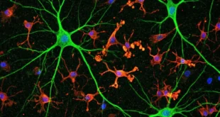 Representación microscópica de células de microglía protegiendo conexiones neuronales en el cerebro humano