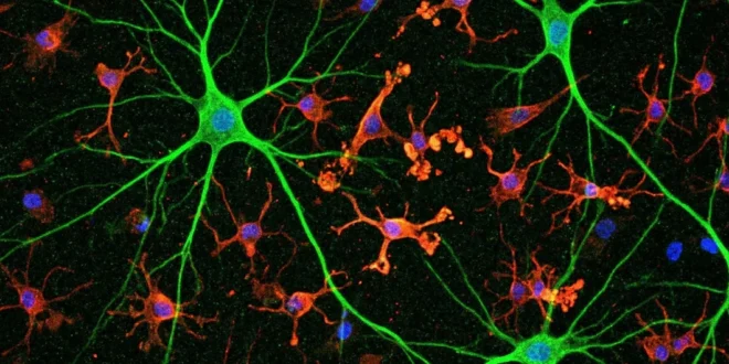 Representación microscópica de células de microglía protegiendo conexiones neuronales en el cerebro humano