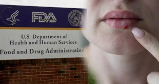 Aprobación de la FDA del pritelivir (HOVILPRI) para el herpes resistente