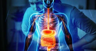 Síndrome de Intestino Irritable (SII) y criterios Roma V