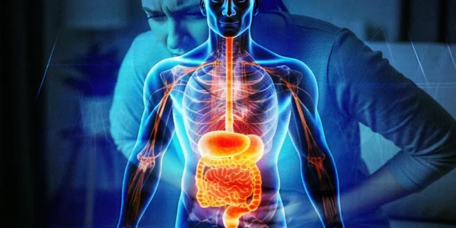 Síndrome de Intestino Irritable (SII) y criterios Roma V